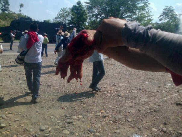 Paro cafetero, la forma que le qued la mano a Ricardo Amado.